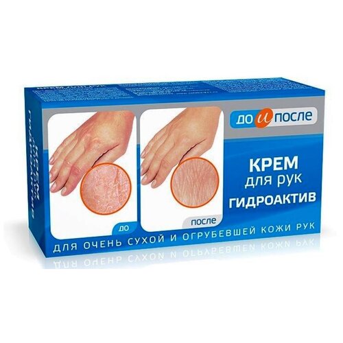Крем для сухой кожи рук До и После Гидроактив 100 мл 642₽