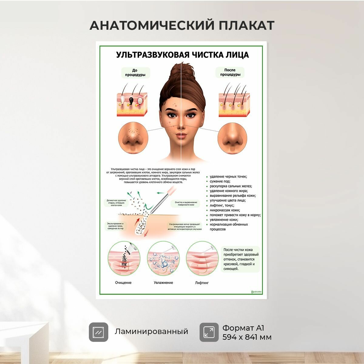 Обучающий медицинский плакат косметология Ультразвуковая чистка лица А1