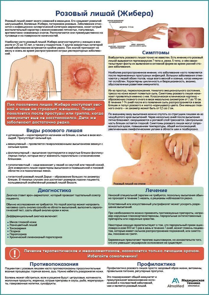 Розовый лишай (Жибера) медицинский плакат