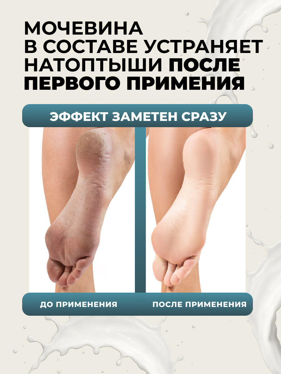 Крем для ног Буренка увлажняющий питательный с мочевиной для очень сухой кожи ног от трещин, мозолей и натоптышей 100мл — фото 1