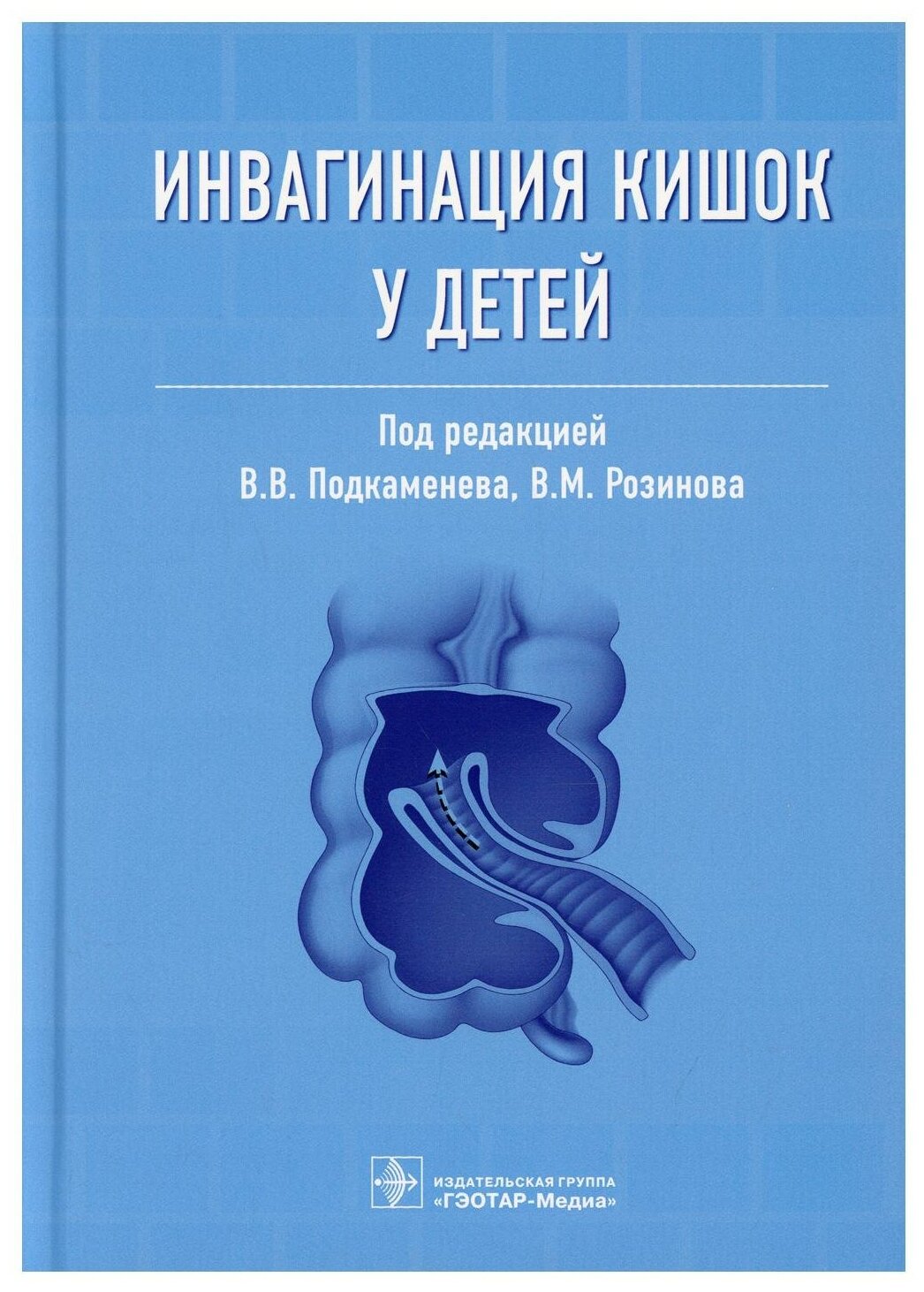 Инвагинация кишок у детей. Руководство - фото №1