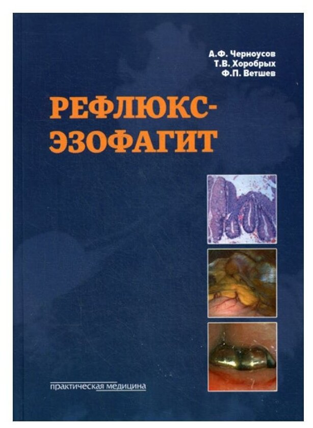 Рефлюкс-эзофагит (Черноусов Александр Федорович, Хоробрых Татьяна Витальевна, Ветшев Федор Петрович) - фото №1