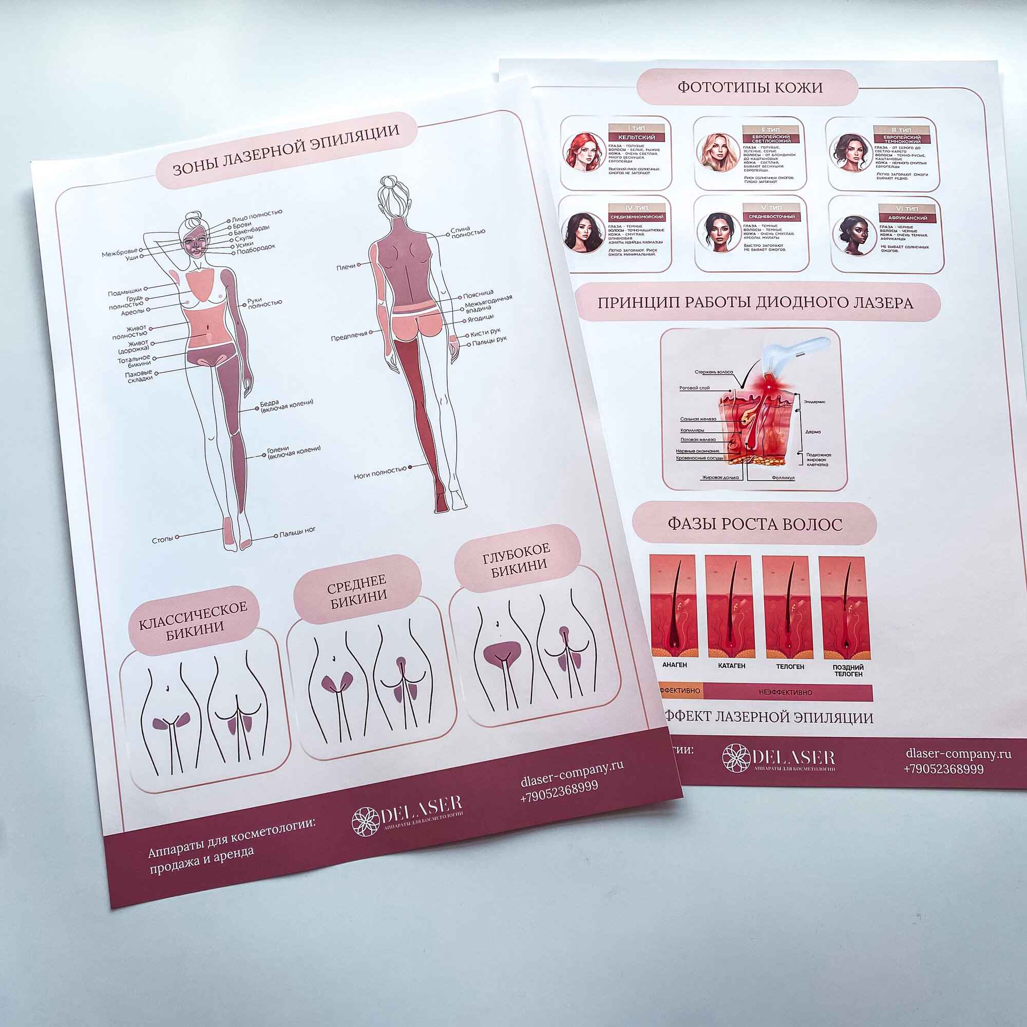 Плакаты для салона лазерной эпиляции (Зоны лазерной эпиляции)