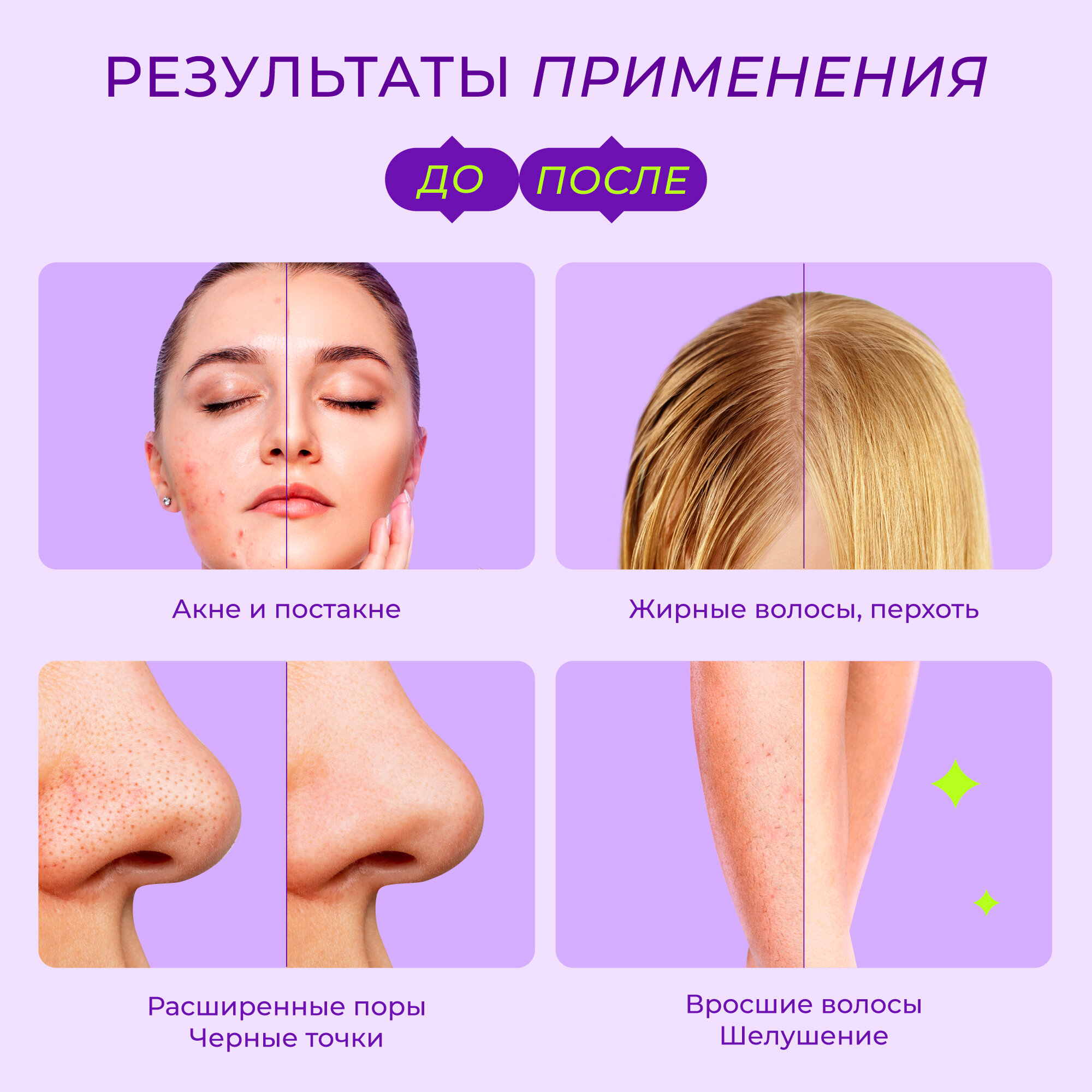 Энзимная пудра-пилинг для тела WISTERY, от вросших волос и гиперпигментации, 150 мл — фото 1