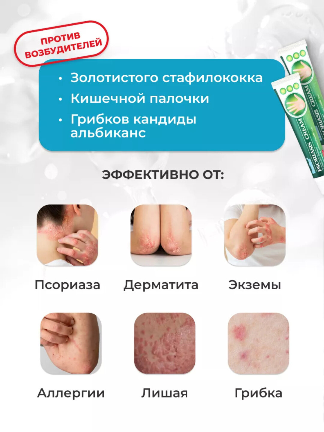 Крем, против псориаза и дерматита, натуральный, гипоаллергенный, 60 г — фото 1