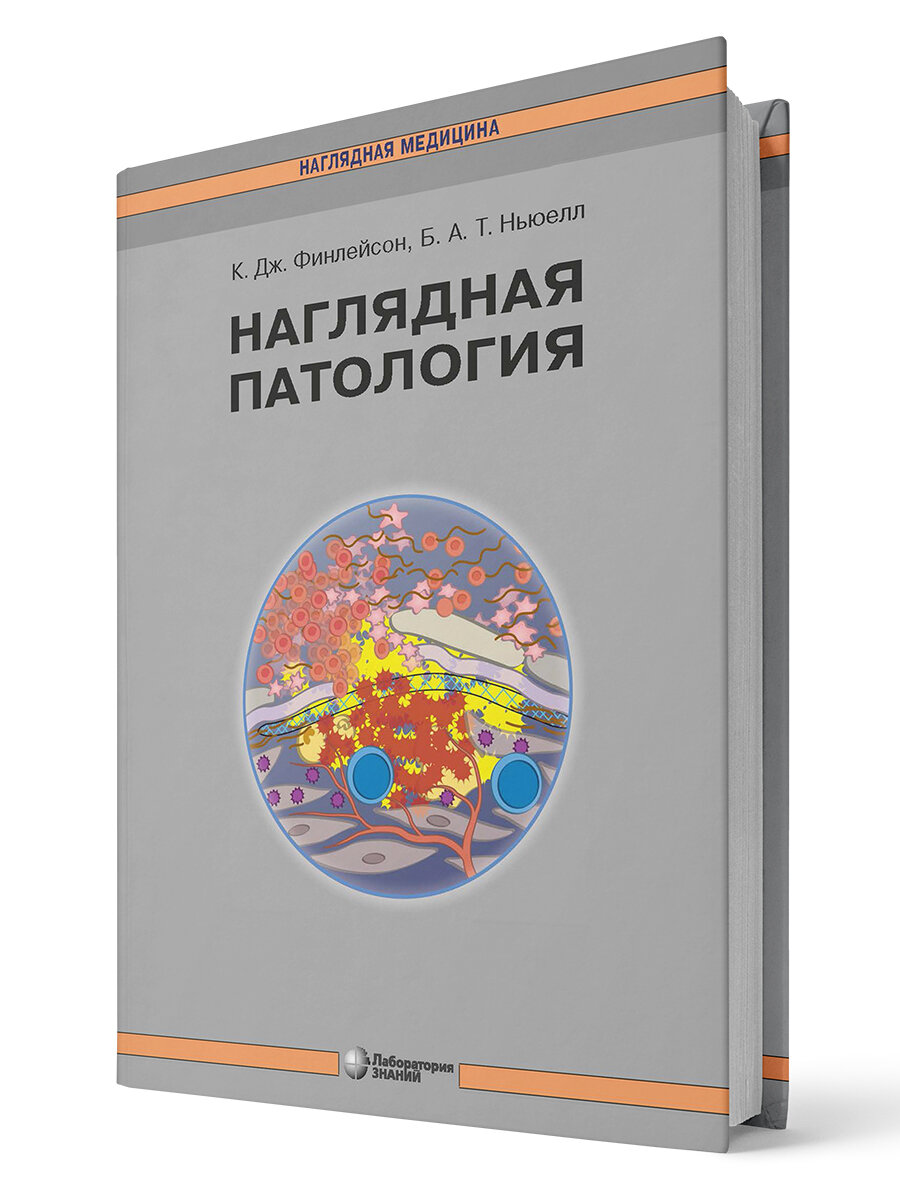 Наглядная патология (Финлейсон К. Дж., Ньюелл Барри А. Т.) - фото №2