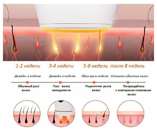 Профессиональный фотоэпилятор IPL / для лица, тела, зоны бикини, 999 999 вспышек / Фото эпилятор лазер, женский лазерный эпилятор - фотография № 4