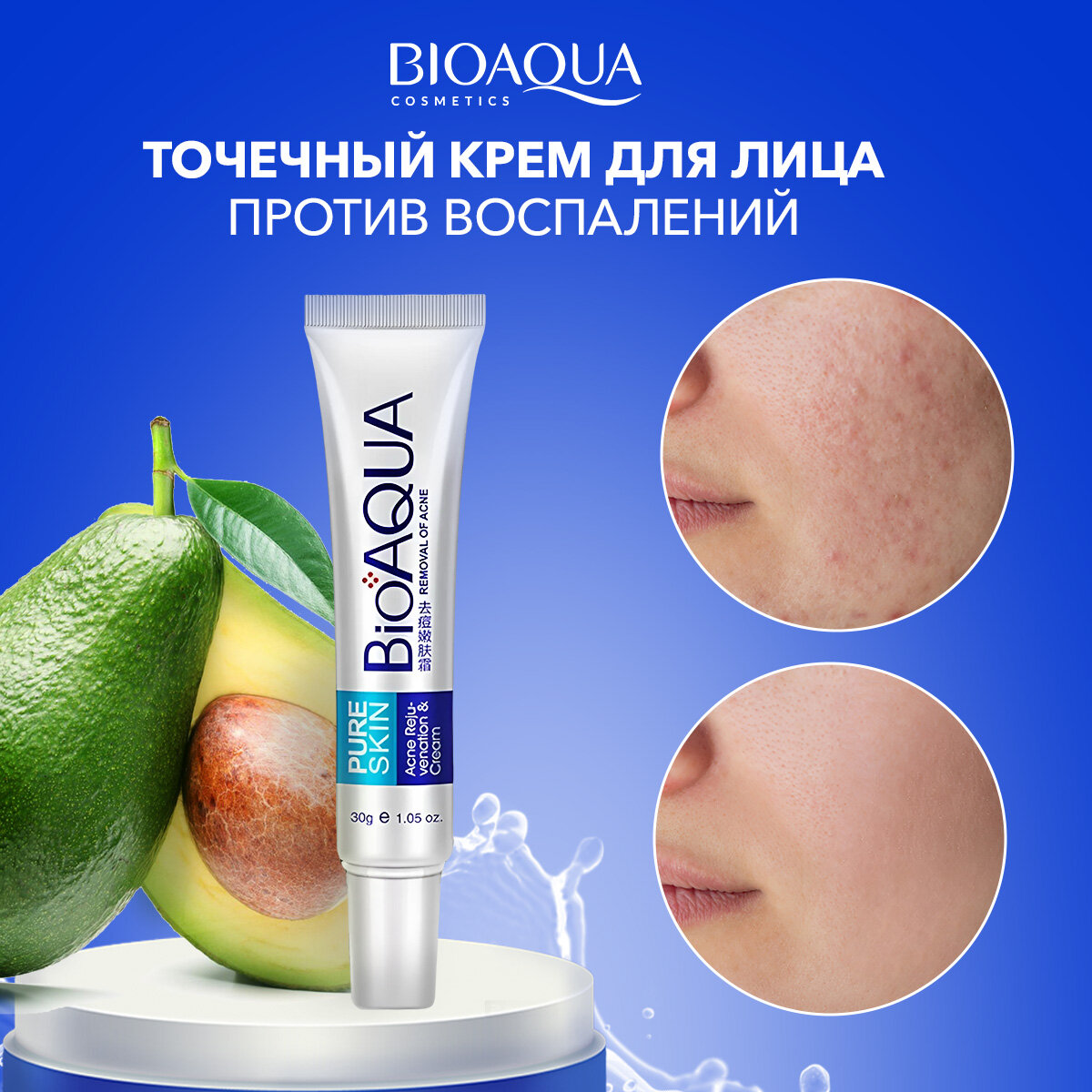 BioAqua Концентрированный крем от прыщей и акне для точечного применения Pure Skin, 30 мл