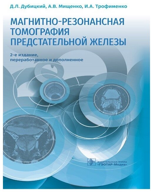 Магнитно-резонансная томография предстательной железы - фото №1