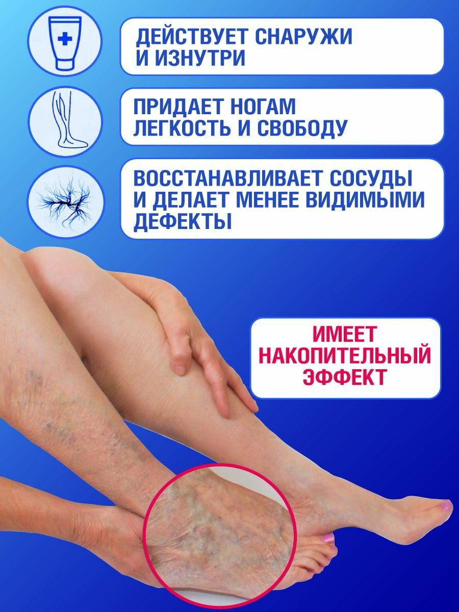 Акулья сила. Чудо мазь " ВенаХаш " . Крем от варикоза, от тяжести в ногах, от боли в ногах, от отеков. 75 мл / лучикс — фото 1