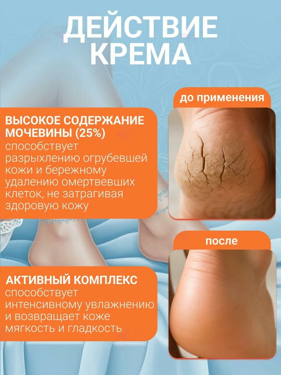 Крем для ног Floresan Ф-618 "Кератодерм" с мочевиной, регенерирующий, 25% мочевины, 100 мл — фото 1