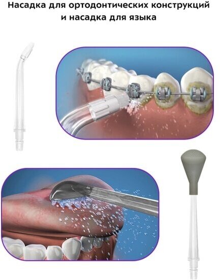Ирригатор для полости рта Kitfort КТ-2940-1 бело-розовый - фотография № 15