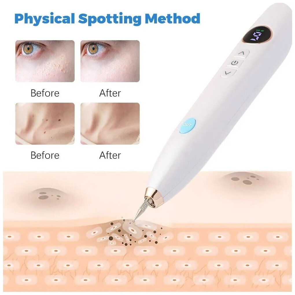 OLLO Store Плазменная ручка (Mole Freckle Removal Pen) для удаления бородавок и папиллом. Версия 5. - фотография № 6