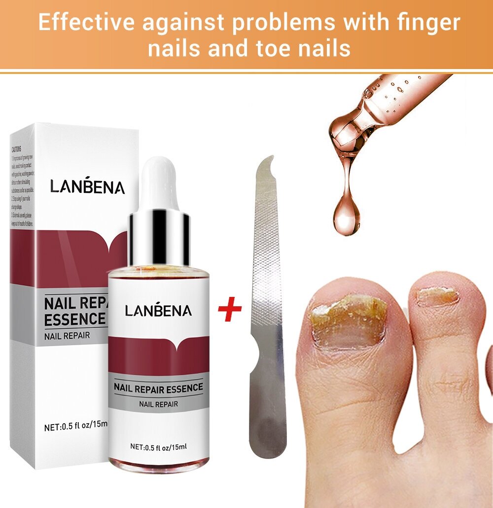 Средство от грибка ногтей на ногах LANBENA в наборе 2 шт / Уход за ногтями, борьба с несовершенствами / Ланбена противогрибковое для роста и укрепление