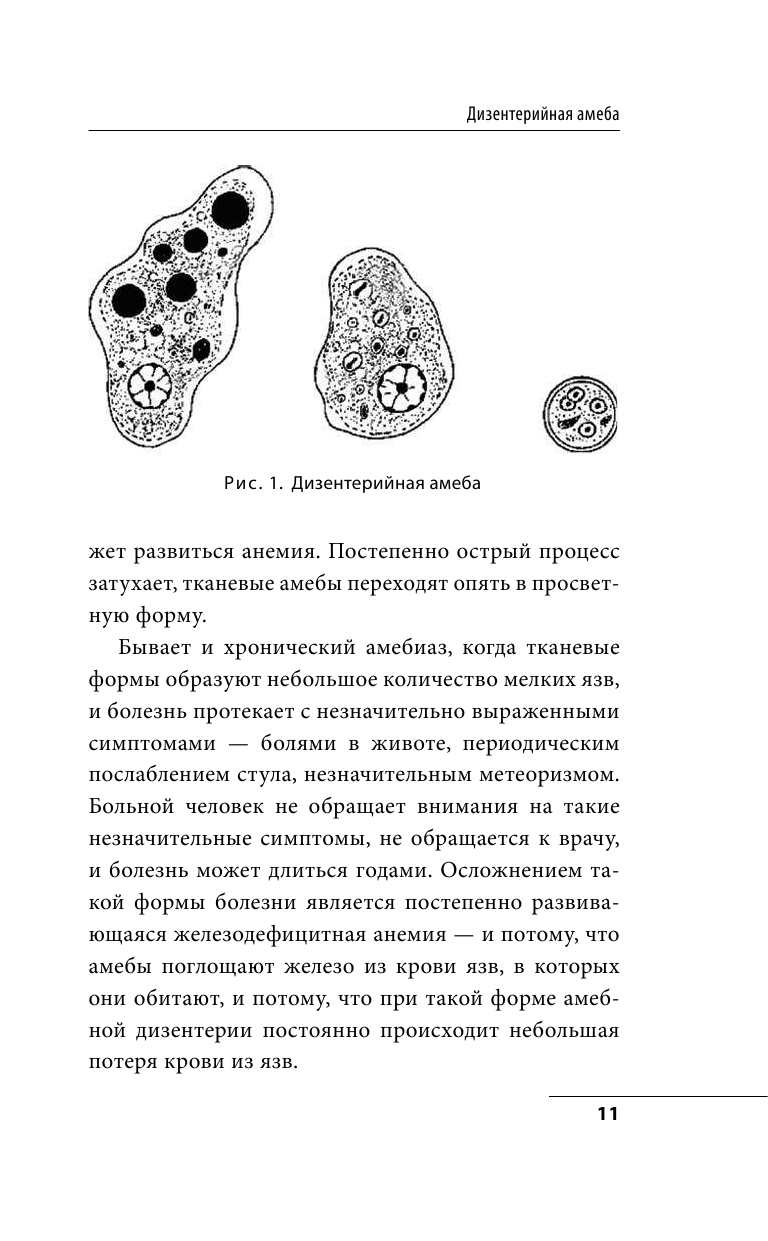 Опасные соседи. Как распознать паразитов, не впасть в панику и свести вред для организма к минимуму - фото №10