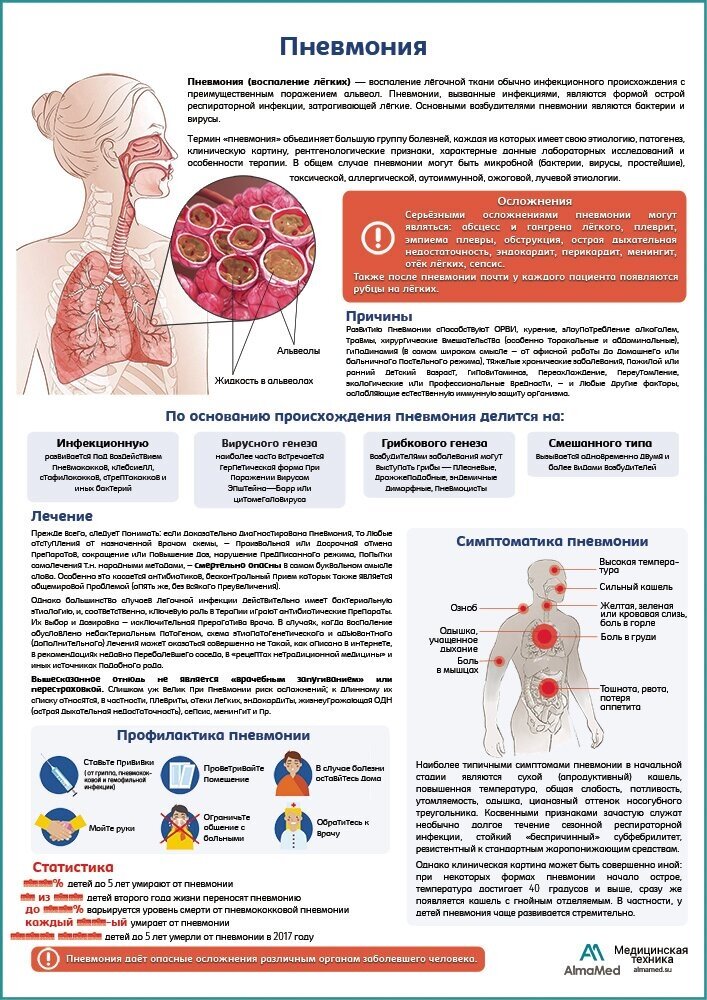Пневмония медицинский плакат, глянцевая фотобумага от 200 г/кв. м, размер A1+