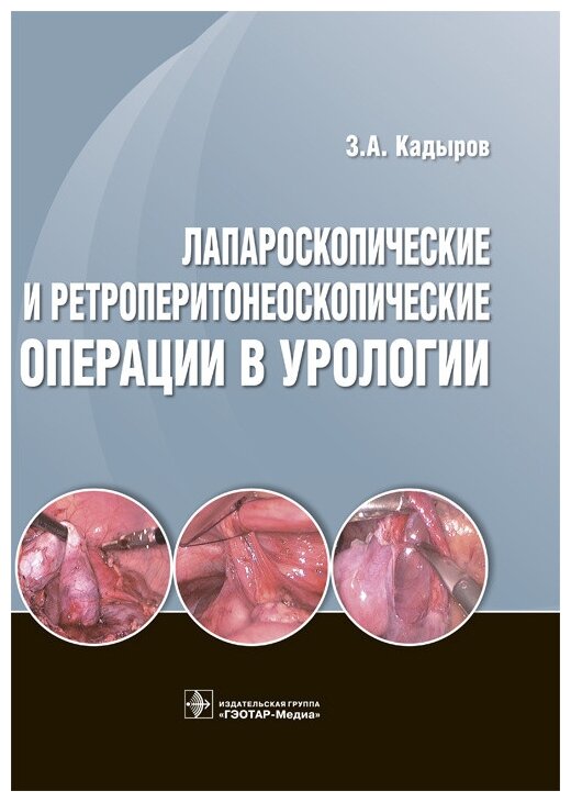 Лапароскопические и ретроперитонеоскопические операции в урологии - фото №1