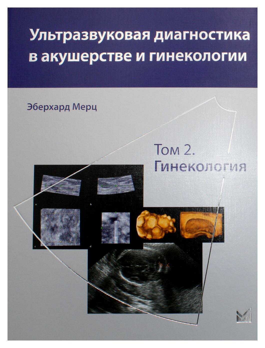 Ультразвуковая диагностика в акушерстве и гинекологии: В 2 т. Т. 2: Гинекология. 2-е изд