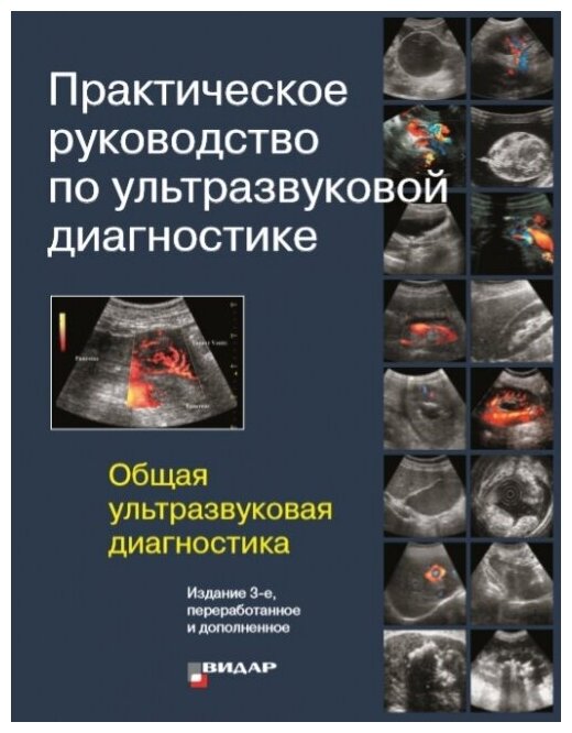 Книга Практическое руководство по ультразвуковой диагностике. 3-е изд. Общая ... - фото №6