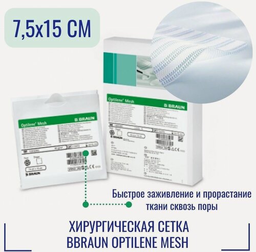 Изображение товара Сетка хирургическая BBraun Optilene Mesh 7,5х15 см
