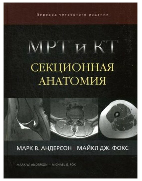 МРТ и КТ. Секционная анатомия (Марк В. Андерсон, Майкл Дж. Фокс) - фото №1