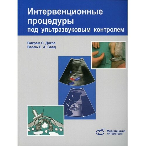 Догра В., Саад В. "Интервенционные процедуры под ультразвуковым контролем"