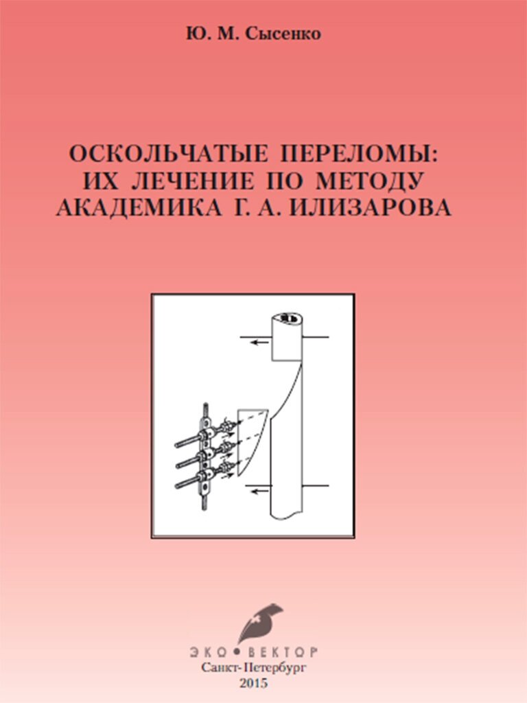 Оскольчатые переломы. Их лечение по методу академика Г. А. Илизарова. Монография - фото №2