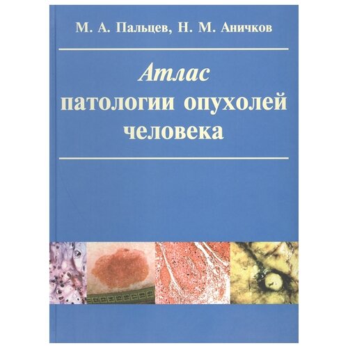 Аничков Николай Мильевич, Пальцев Михаил Александрович "Атлас патологии опухолей человека"