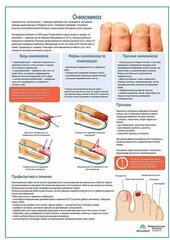 Онихомикоз медицинский плакат глянцевая фотобумага от 200 г/кв. м, размер A2+