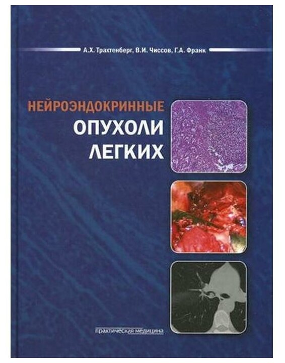 Книга Нейроэндокринные Опухоли легких - фото №1