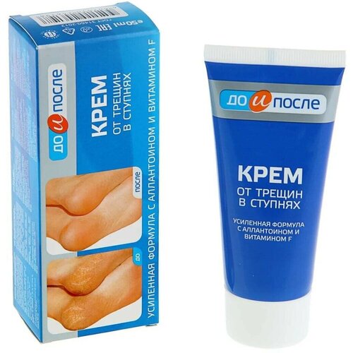 Крем для ног от трещин в ступнях, 