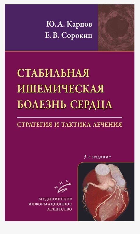 Стабильная ишемическая болезнь сердца: Стратегия и тактика лечения / Карпов Ю. А, Сорокин Е. В.