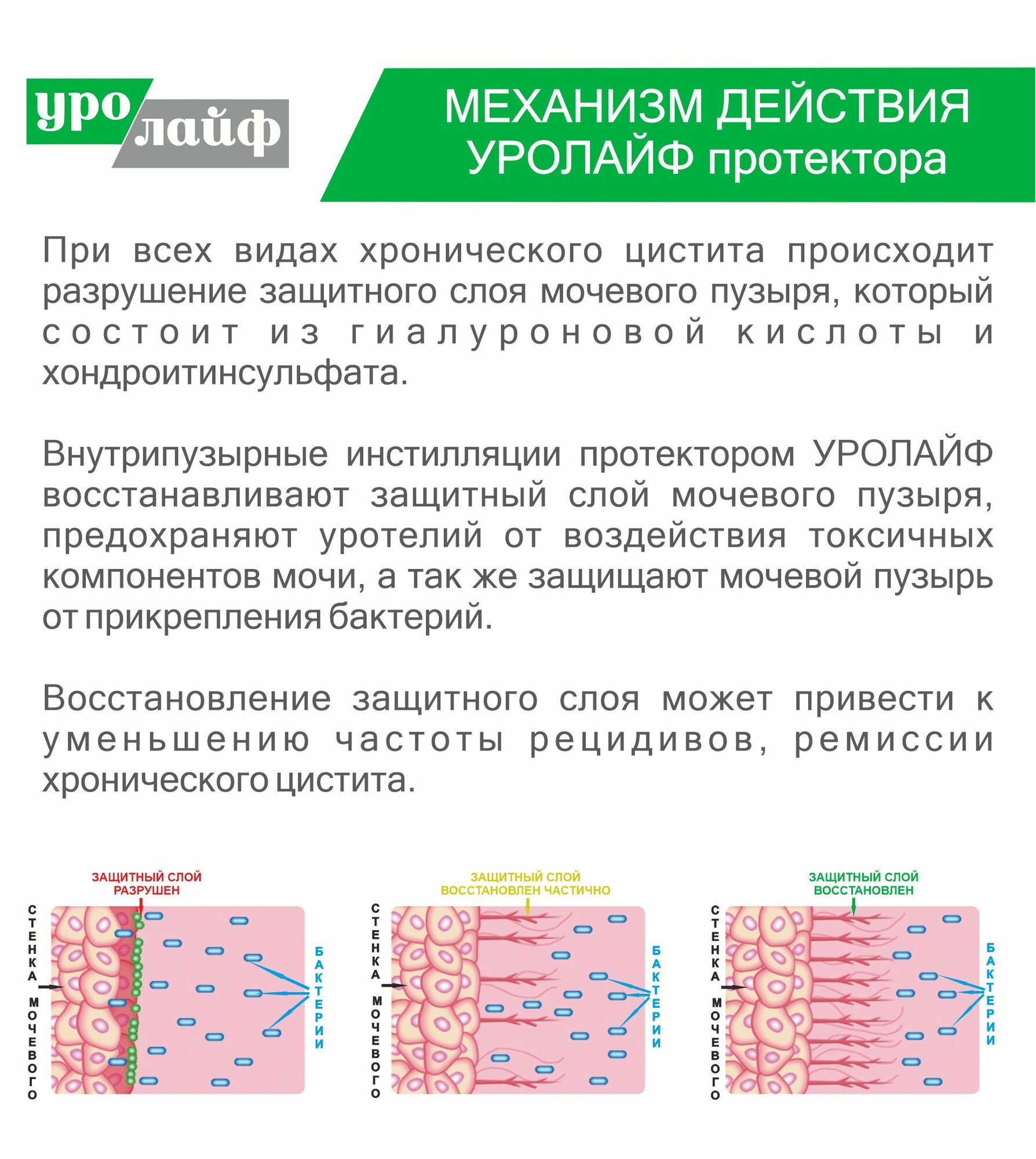 Изображение Уролайф протектор, 50 мл, цистит (шприц и катетер в комплекте)