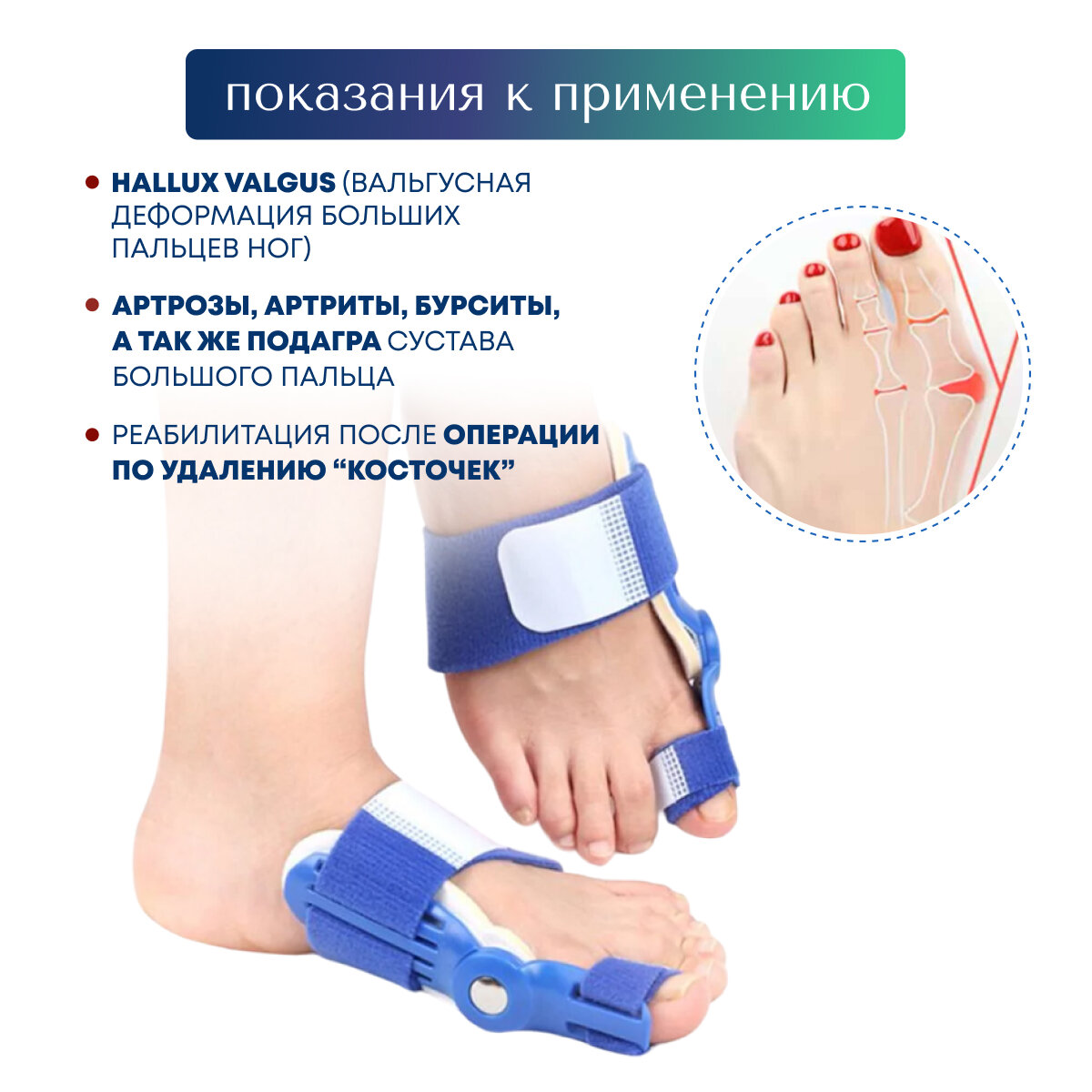 Картинки Ортопедическая шина MyBalance от вальгусной деформации большого пальца, с регулировкой отведения, синяя, 1 шт