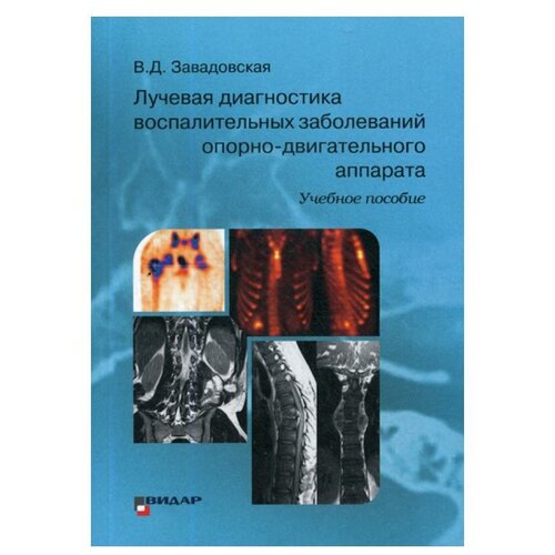 Лучевая диагностика воспалительных заболеваний опорно-двигательного аппарата