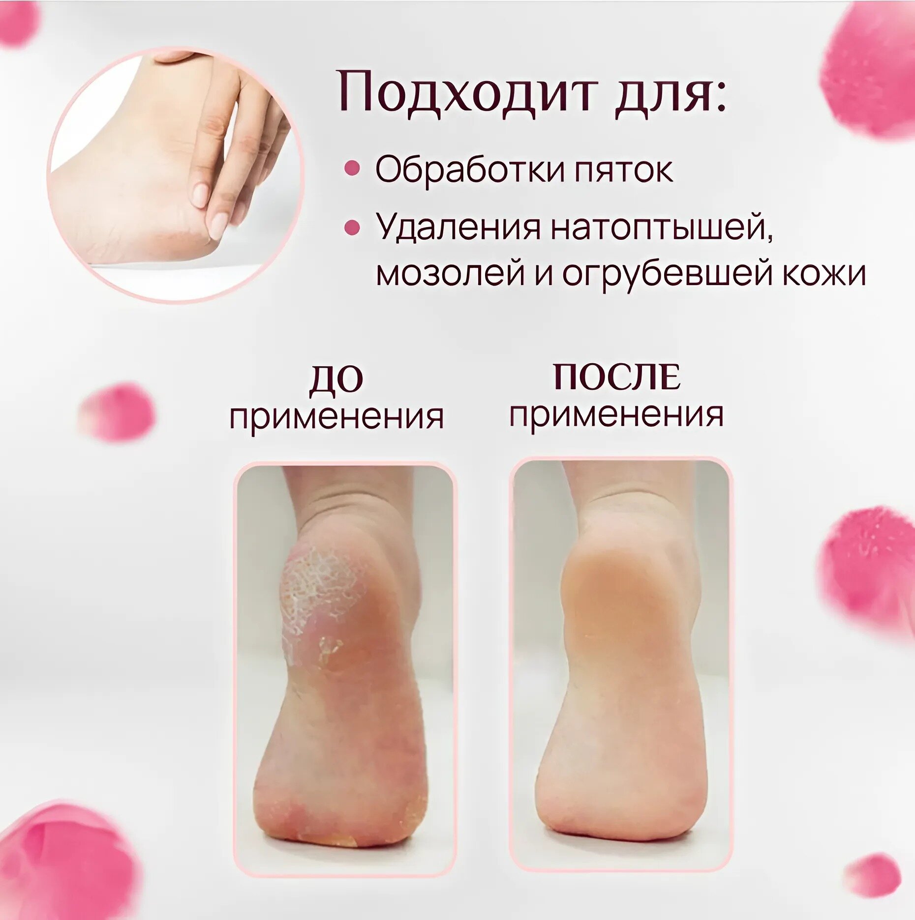 Изображение Электрическая пемза для ног , Роликовая пилка для педикюра, розовый