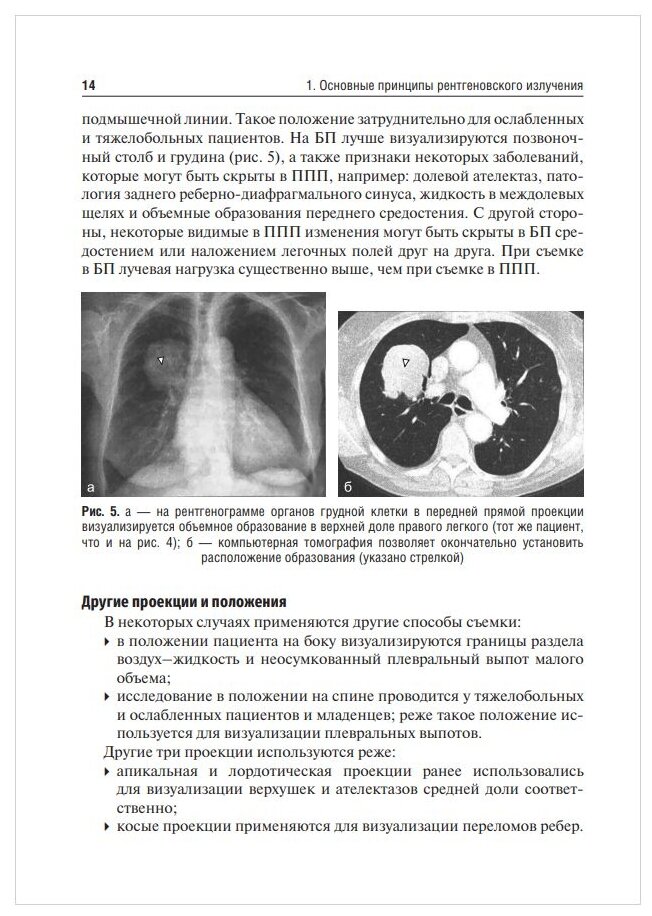 Лучевая диагностика туберкулеза легких. Учебное пособие - фото №11