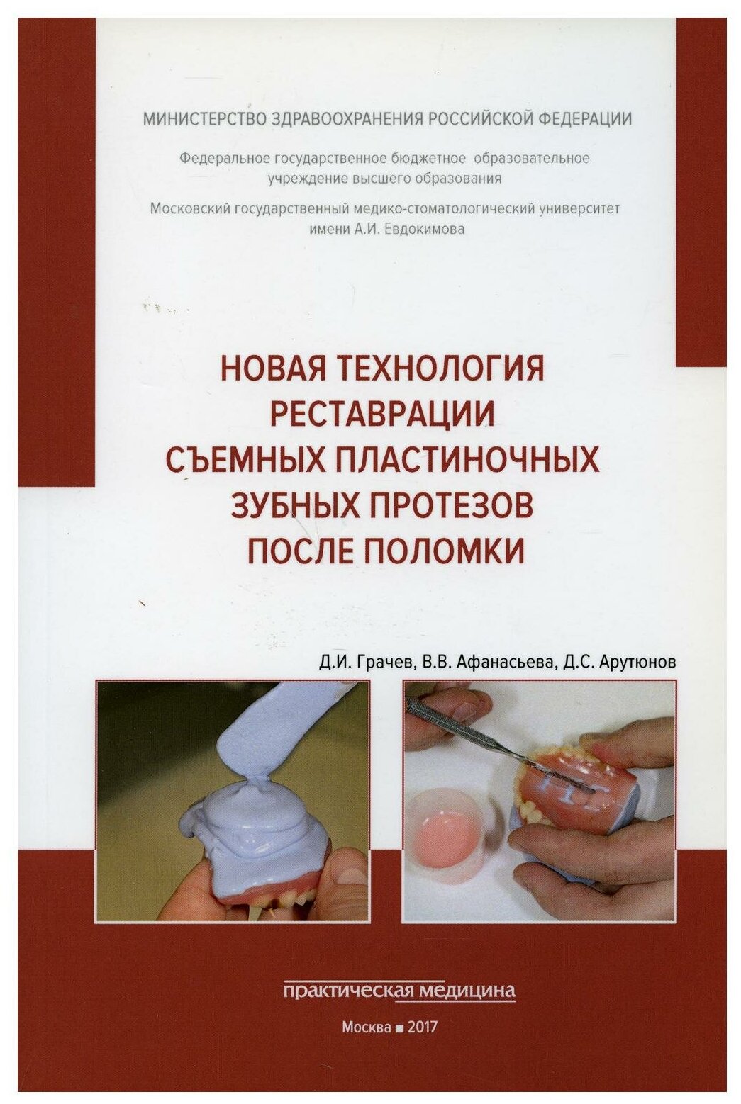 Новая технология реставрации съемных пластиночных зубных протезов после поломки (Грачев Д. И.)