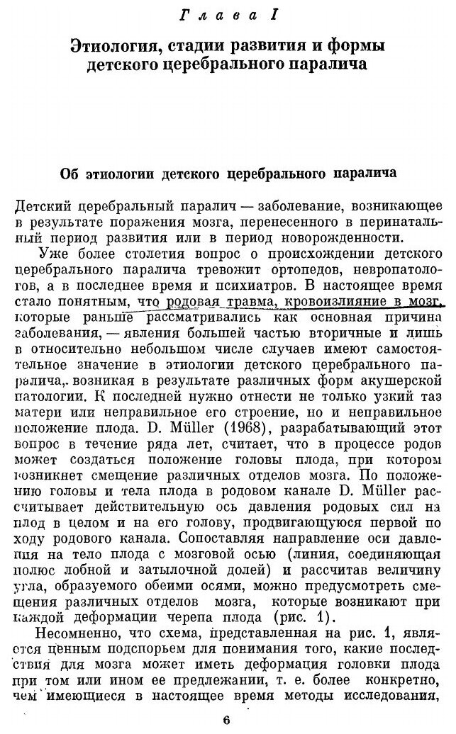 Клиника и реабилитационная терапия детских церебральных параличей - фото №3