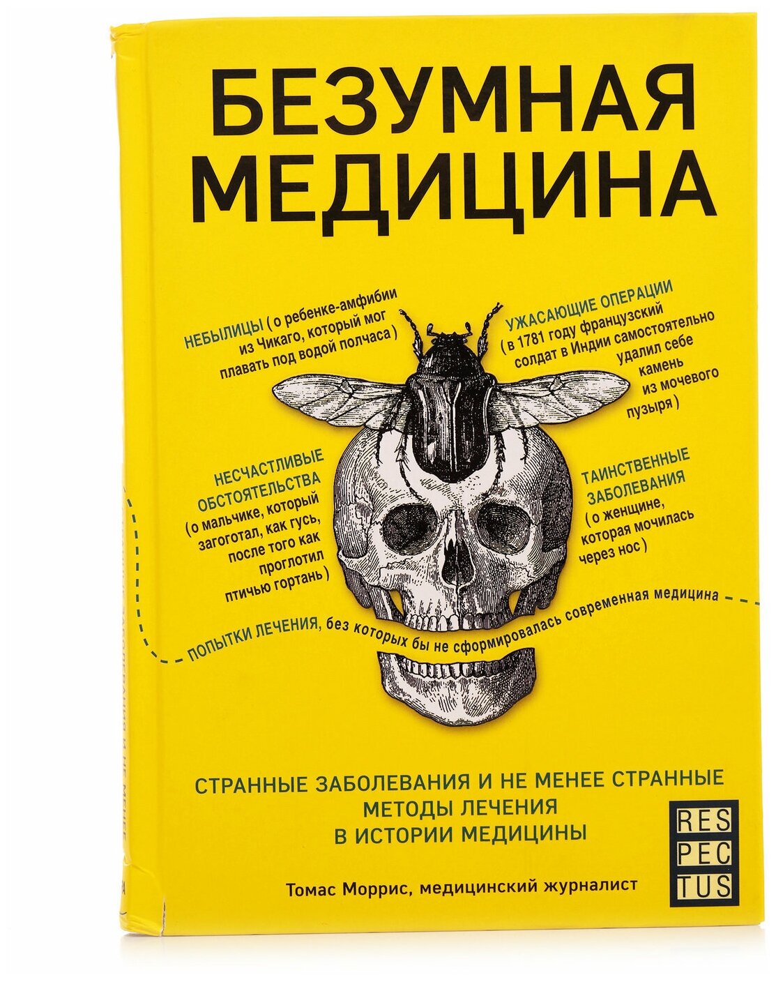 Безумная медицина. Странные заболевания и не менее странные методы лечения в истории медицины - фото №6