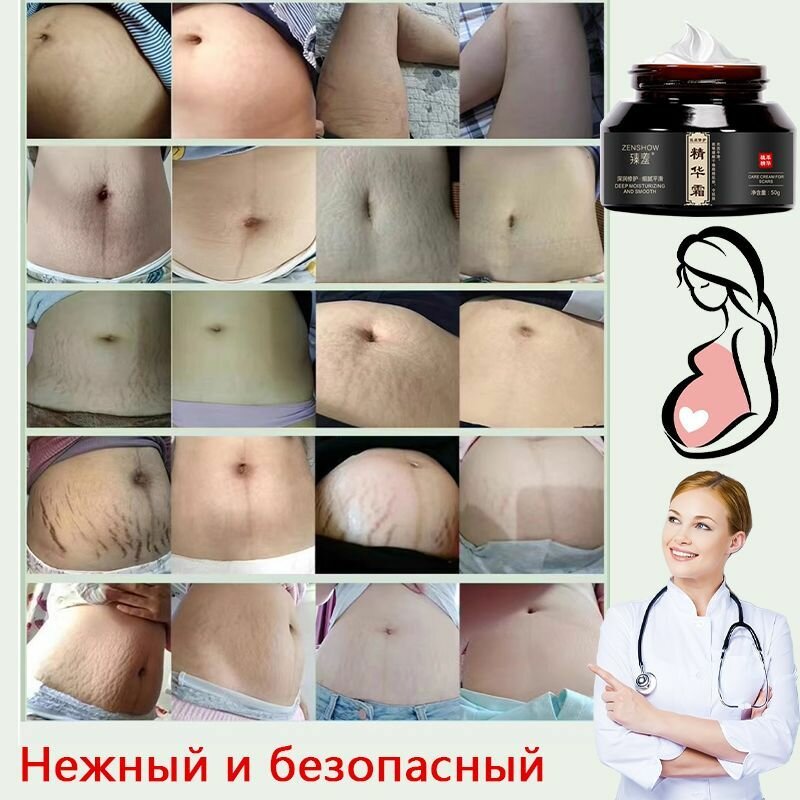 Картинки Средство от растяжек