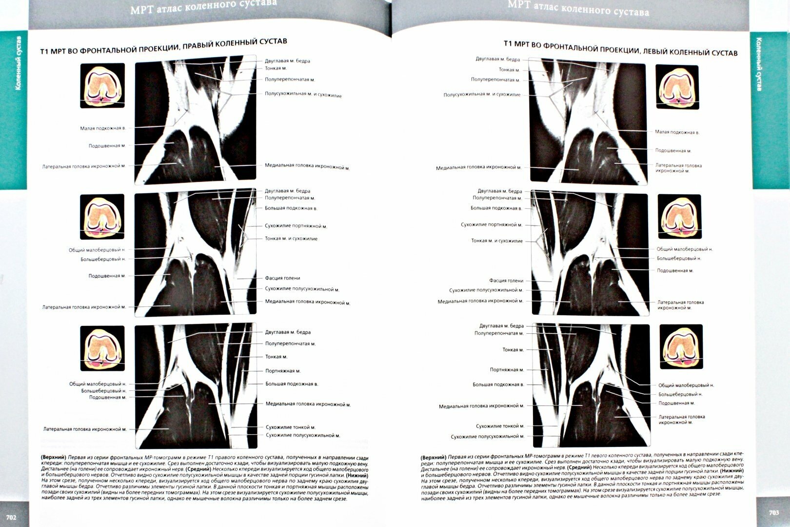 Лучевая анатомия. Кости, мышцы, связки - фото №2