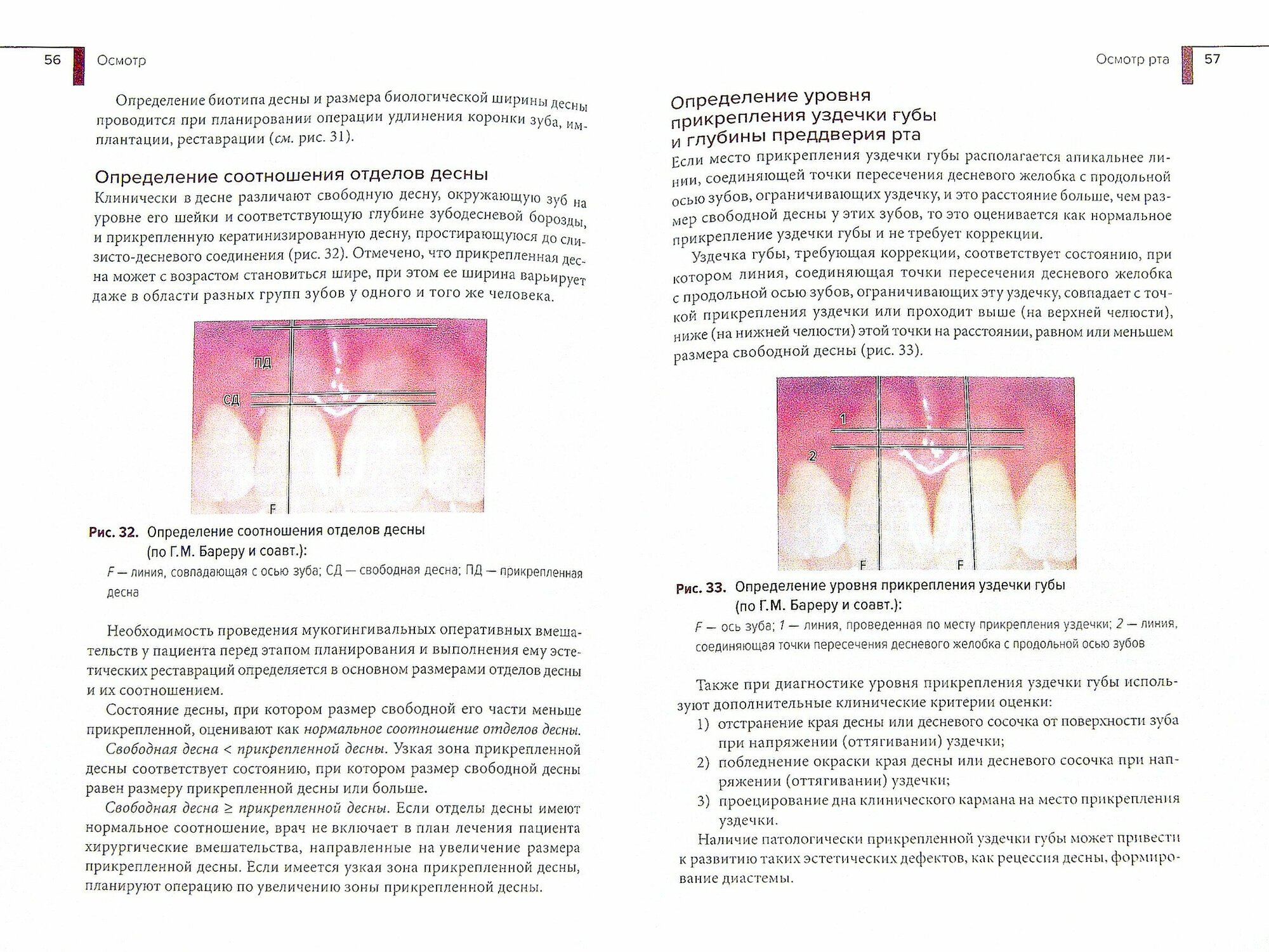 Методы обследования пациента в эстетической стоматологии. Учебное пособие - фото №2