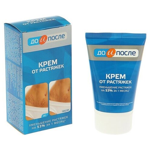 Крем от растяжек 