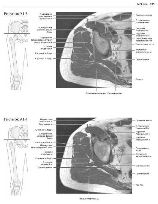 МРТ и КТ. Секционная анатомия (Марк В. Андерсон, Майкл Дж. Фокс) - фото №4