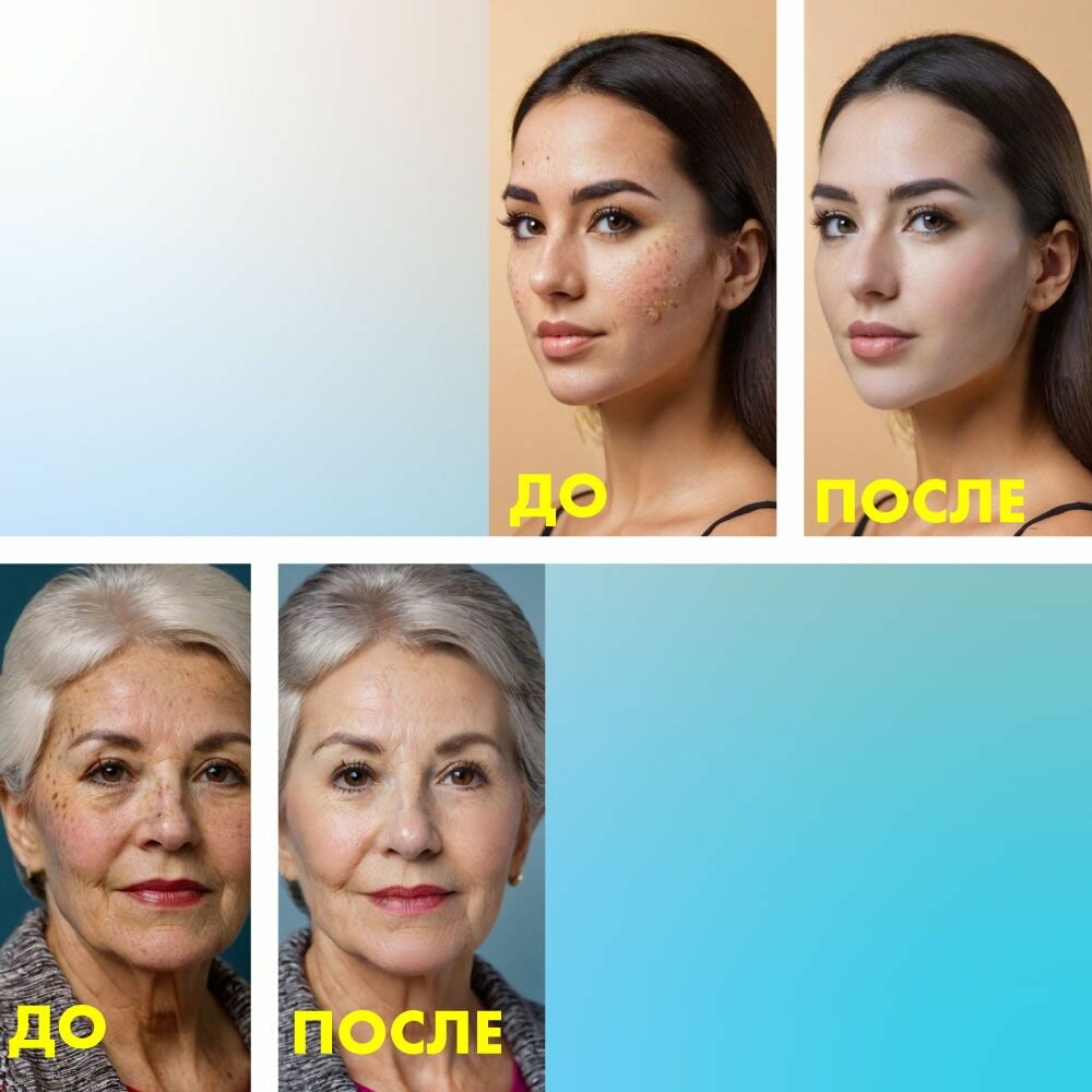 Крем от пигментных пятен для лица, от возрастных пятен, от веснушек, отбеливание интимных зон. Лучикс — фото 1