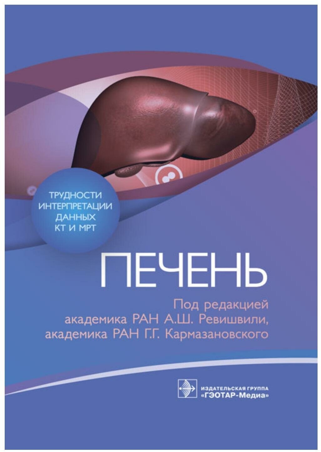 Трудности интерпретации данных КТ и МРТ. Печень - фото №1