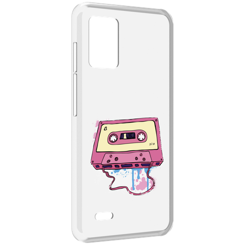 Чехол MyPads Розовая кассета для UMIDIGI Bison X10S / Bison X10G задняя-панель-накладка-бампер