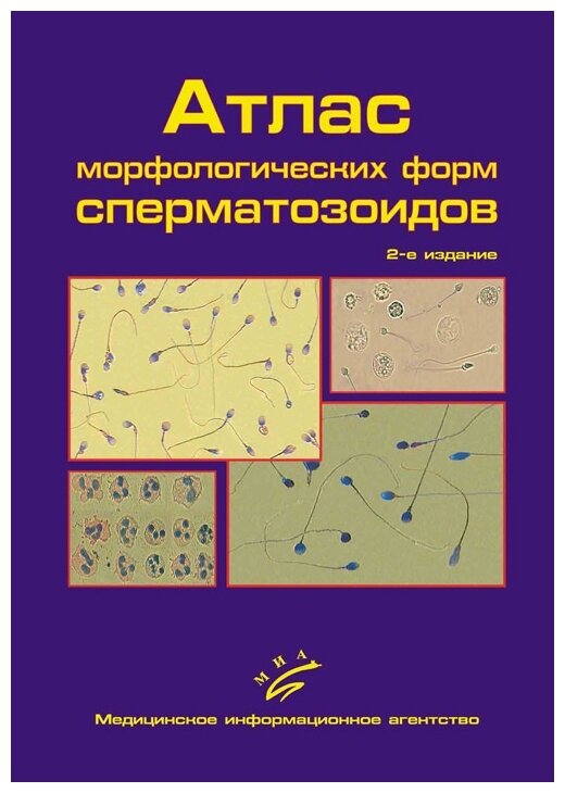 Гончаров Н.П. Добрачева А.Д. Попова Г.М. и др. "Атлас морфологических форм сперматозоидов"