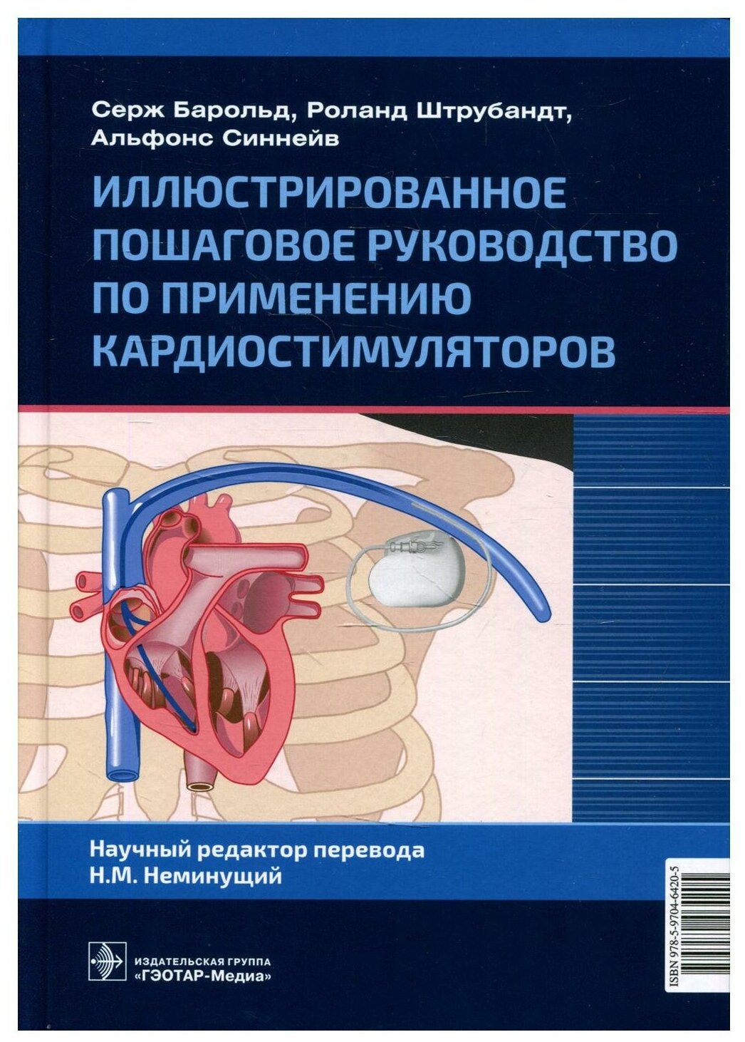 Иллюстрированное пошаговое руководство по применению кардиостимуляторов - фото №1